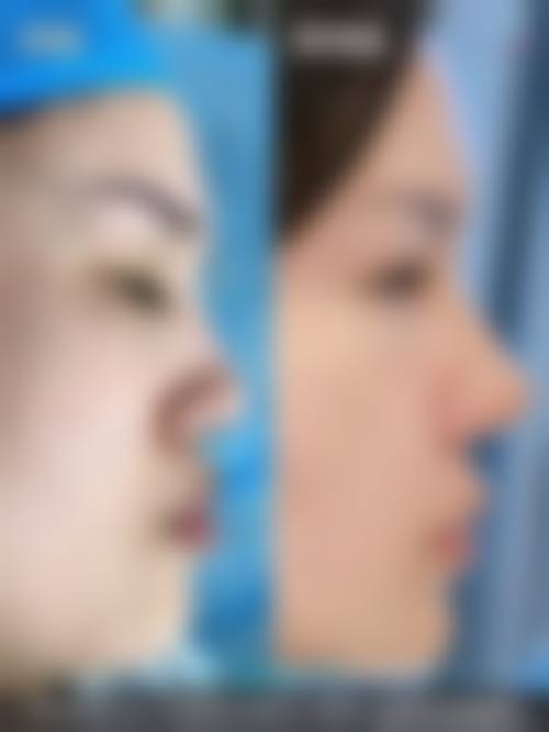 擅长项目详解