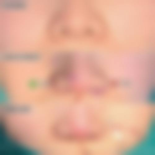 擅长项目详解:上海澳雅医疗美容门诊部张枫