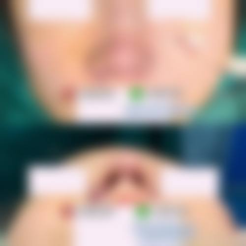 诊疗特色总结:上海澳雅医疗美容门诊部张枫
