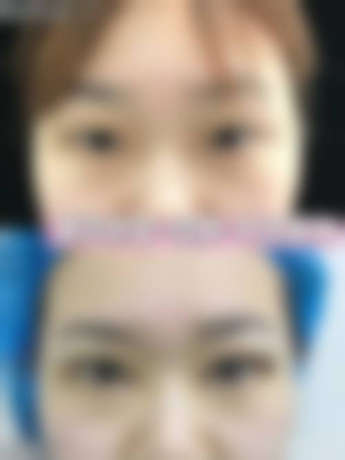 临床实例分享