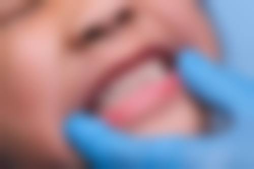 结语：选择博雅，重拾自信笑容