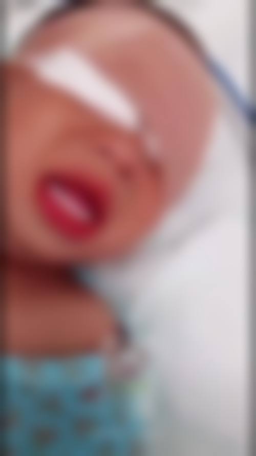 预约优惠活动:钟祥市人民医院眼科成艳兰专属补贴