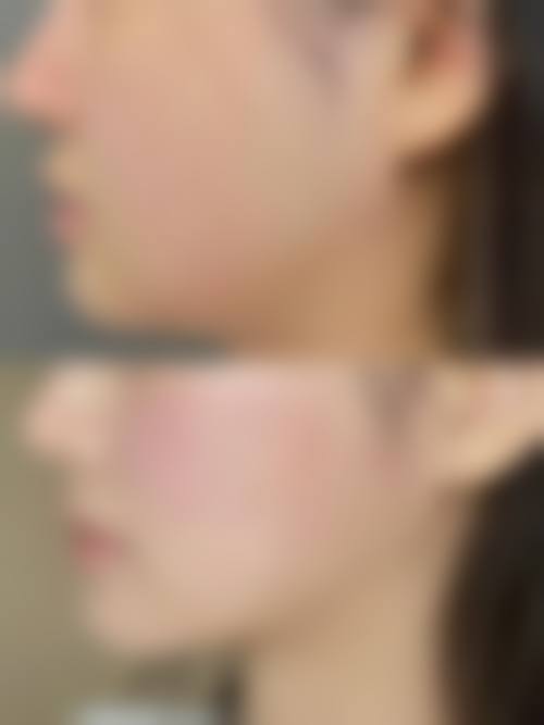 临床实例分享:真实反馈见证成效