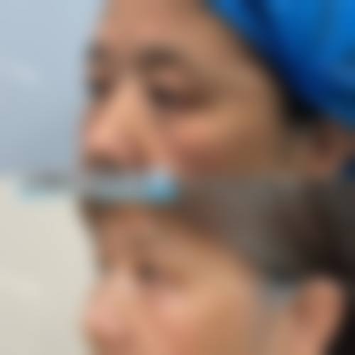 临床实例分享:真实蜕变见证实力