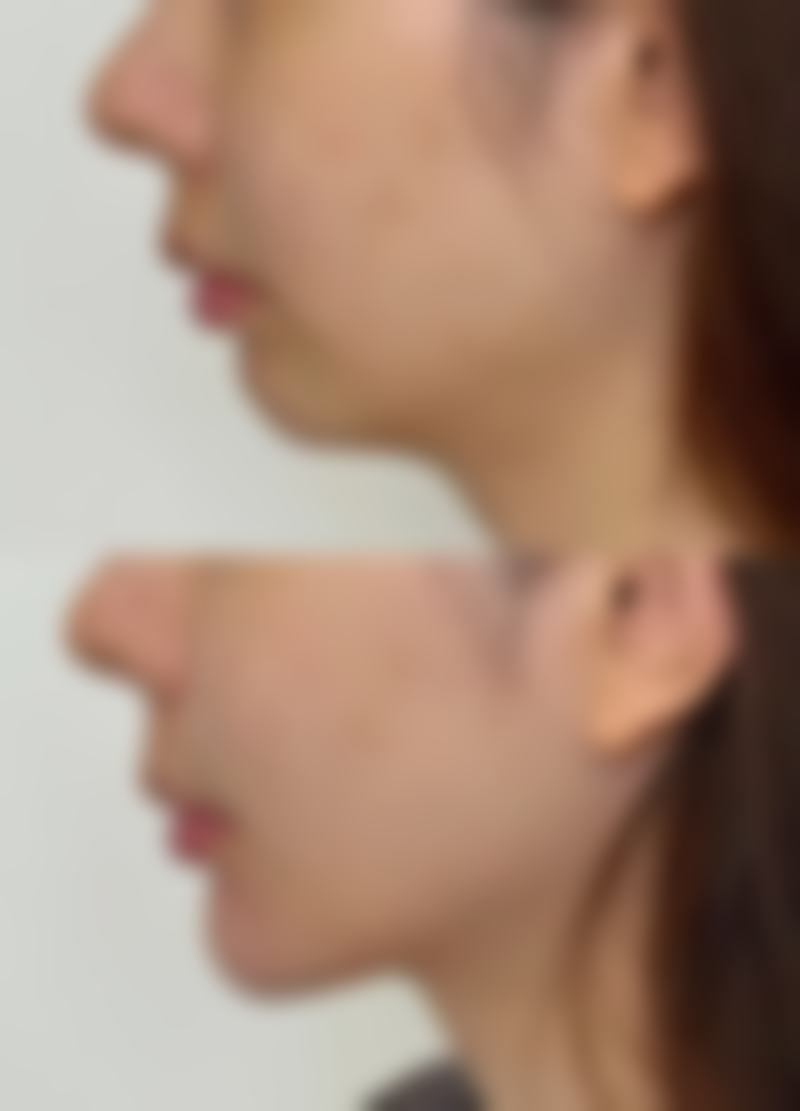 预约优惠活动