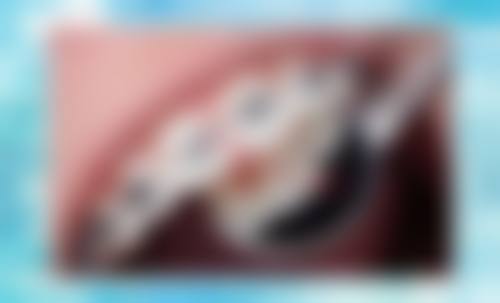 临床实例分享:昆明昆安口腔门诊部何医生