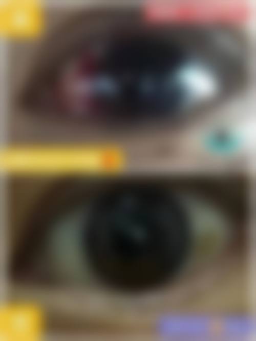 结尾预约号召:立即行动,守护清晰视界