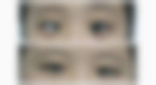 患者真实评价:中南大学湘雅医院眼科毛俊峰口碑汇总
