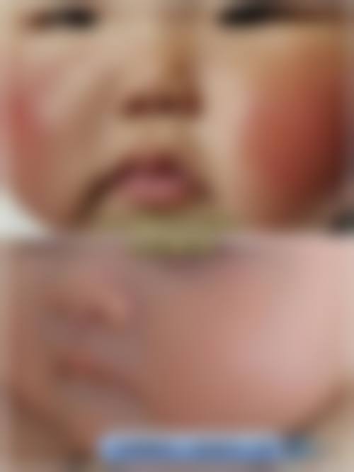 临床实例分享: