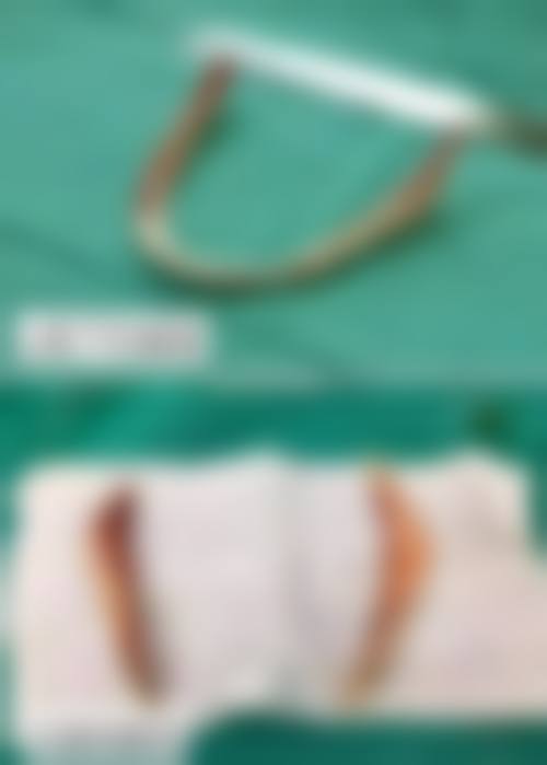 预约优惠活动