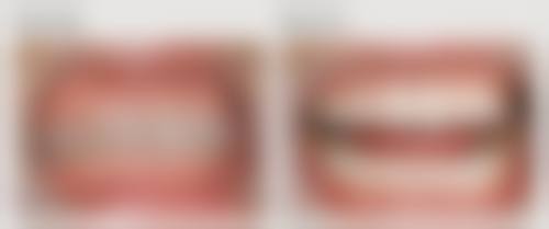 价格体系与优惠活动:透明消费减轻经济负担