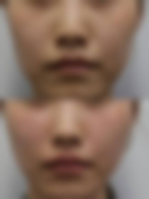 擅长项目详解
