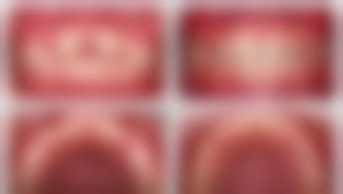 诊疗特色总结杭州口腔医院新杭门诊部骆一帆
