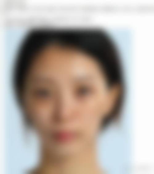 擅长项目详解:广州医学校第二附属医院整形美容中 心俞晓岚