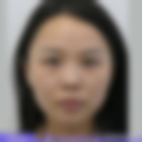 患者真实评价:广州医学校第二附属医院整形美容中 心俞晓岚