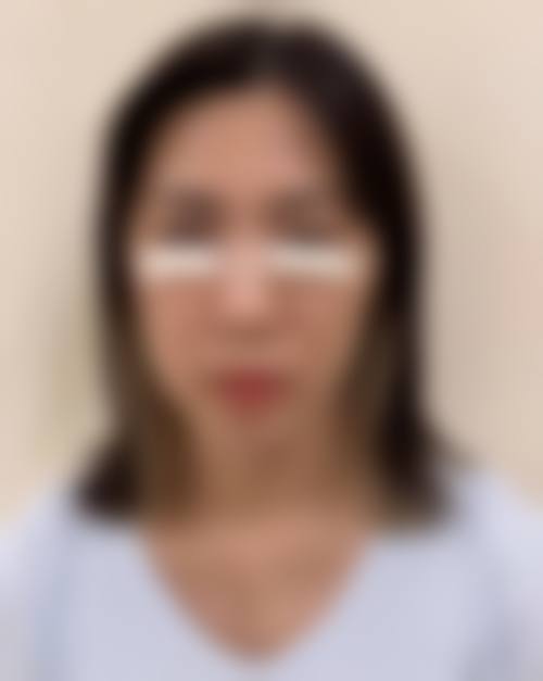 诊疗特色总结：三明艾芙医疗美容诊所黄伟平