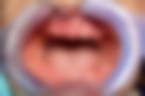 擅长项目详解