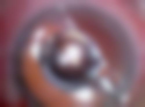 FAQ徐州医 科 大学附属医院眼科郭建新