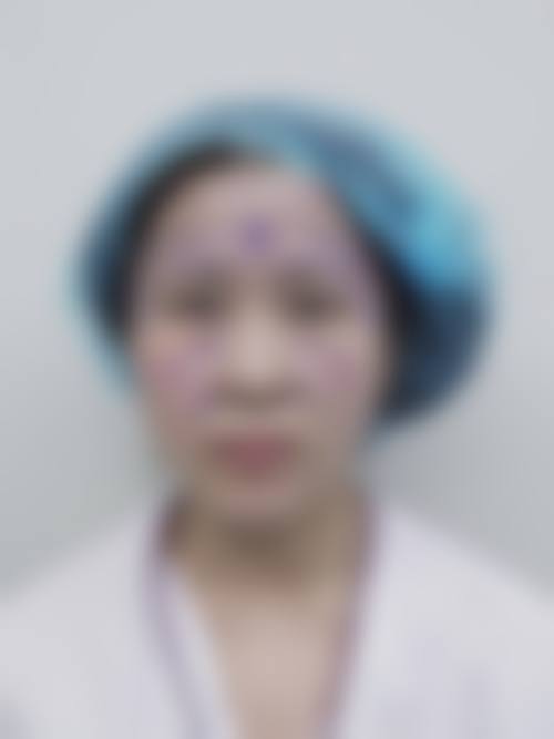 患者真实评价:苏州同济整形美容医院蔡元浩口碑怎样