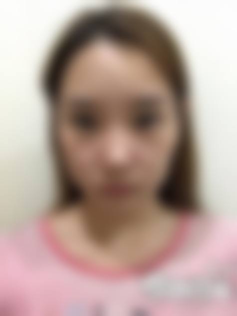 患者真实评价：三明艾芙医疗美容诊所黄伟平