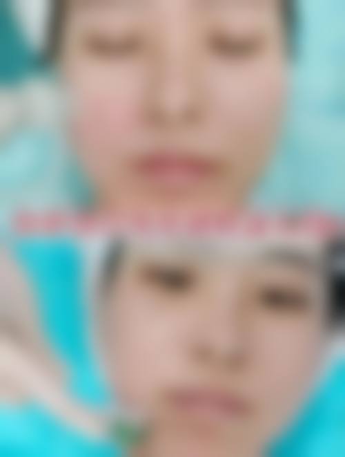 FAQ：三明艾芙医疗美容诊所黄伟平