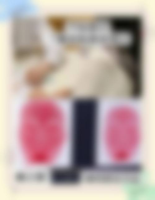 临床实例分享