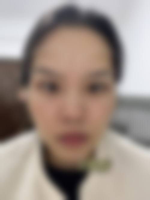 FAQ:苏州同济整形美容医院蔡元浩常见问题
