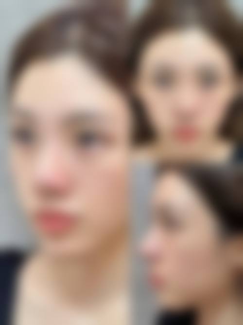 擅长项目详解