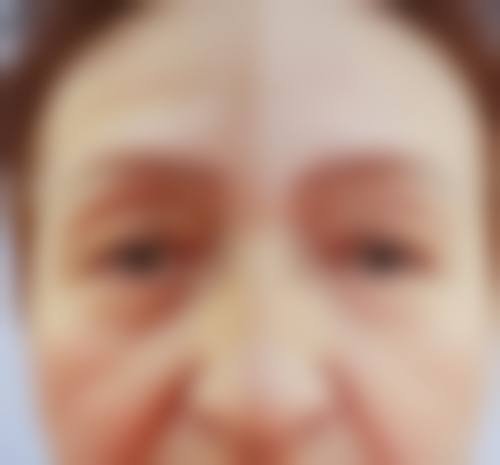 擅长项目详解:苏州同济整形美容医院蔡元浩适合我吗