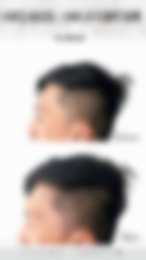 具有影响力FAQ解答:消除您的后顾之忧