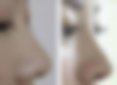 擅长项目详解：三明艾芙医疗美容诊所黄伟平