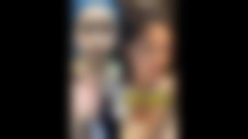 临床实例分享:苏州同济整形美容医院蔡元浩成效如何