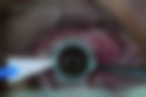 大理爱尔眼科医院