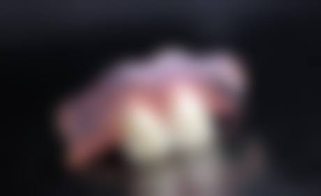擅长项目详解