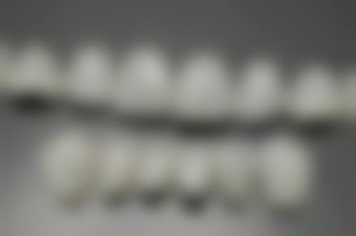 德国威兰德牙冠：高端修复，重塑自然美牙