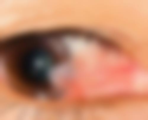 高端设备加持,精细解析眼部健康