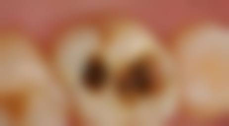 优惠活动详情与FAQ答疑