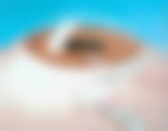 擅长项目详解:马雯医生核心技术解析
