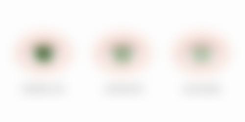诊疗特色总结:淮安光明眼科医院李筱荣的服务理念