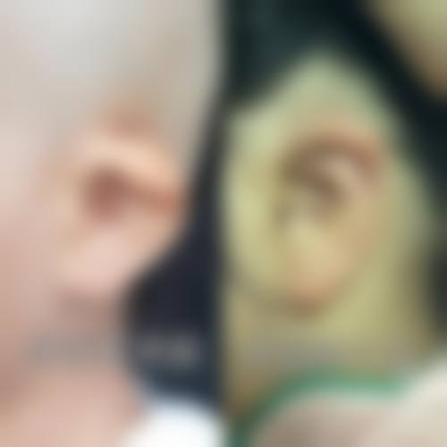 擅长项目详解:深圳新浩创美医疗美容门诊部林富强的核心技术