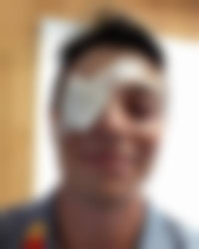 诊疗特色总结:江阴光明眼科医院邹俊