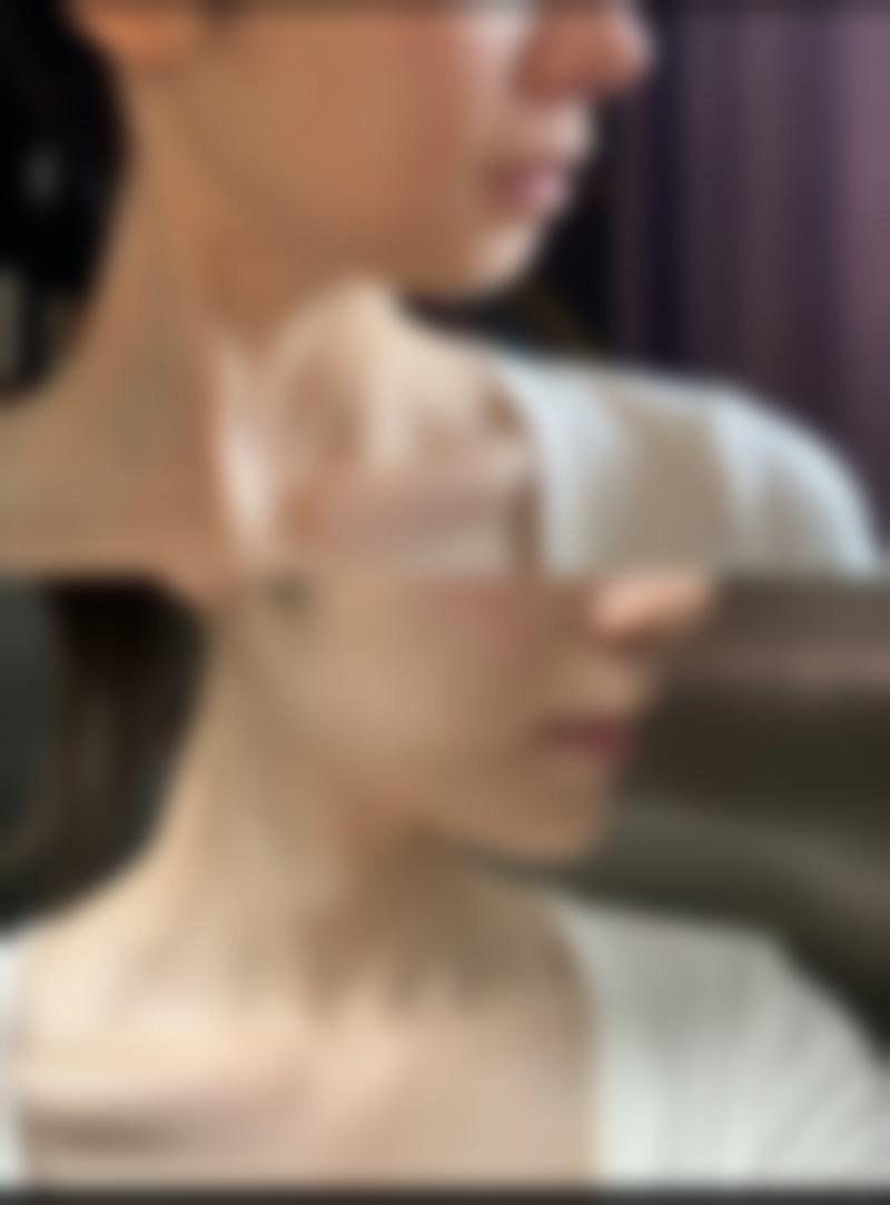 诊疗特色总结：康小燕医生技术优势