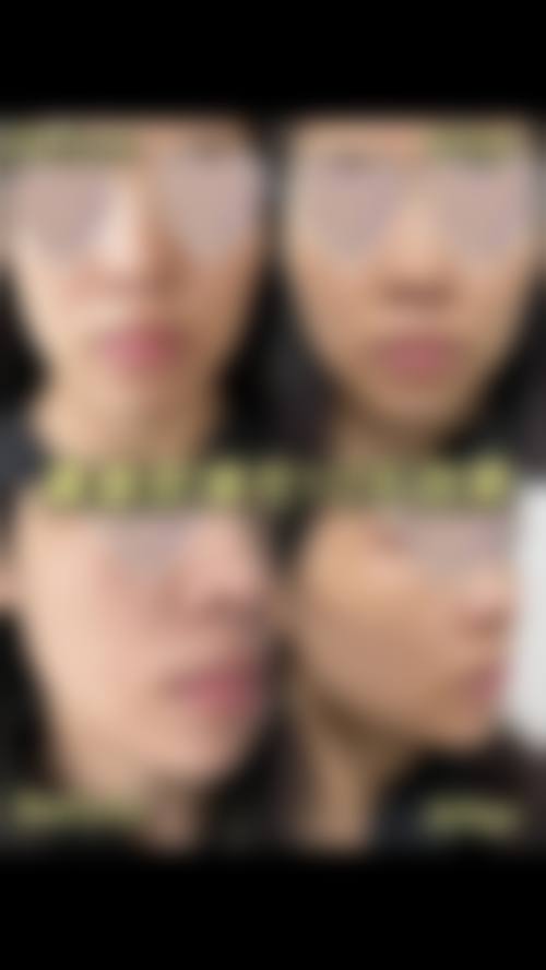 结尾预约号召:立即行动