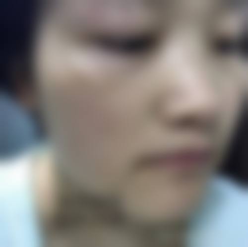 临床实例分享:找陈璇医生治疗能达到理想成效吗?