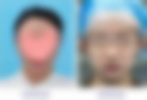 擅长项目详解