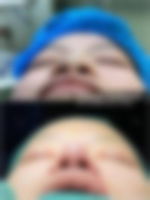 预约优惠活动