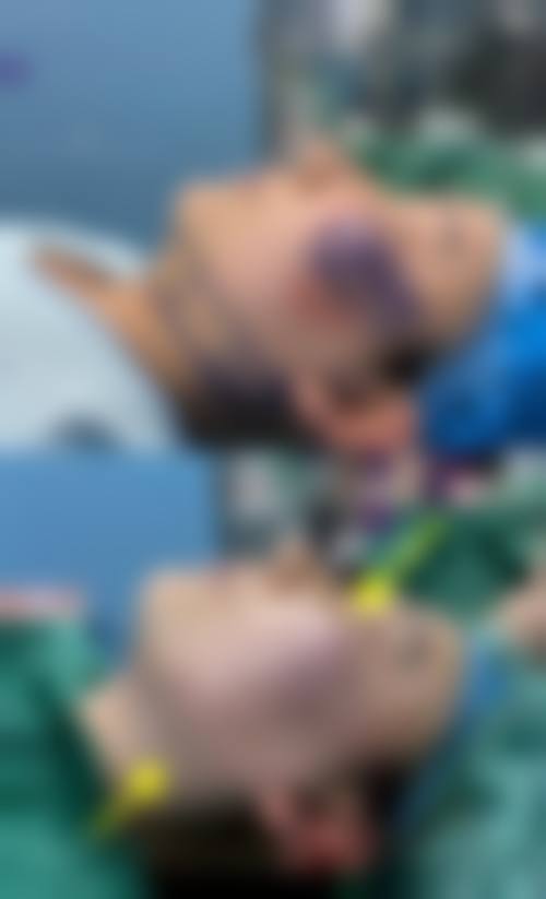患者真实评价福州曙光整形美容医院邢文明