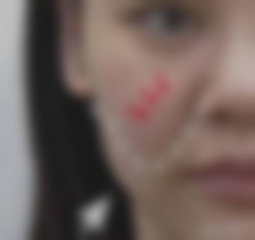 患者真实评价