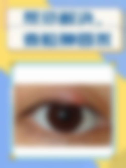 临床实例分享