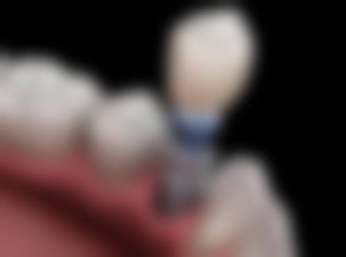 结尾预约号召：立即行动，重拾自信笑容北京佳美口腔(通州新光大门诊)康启超